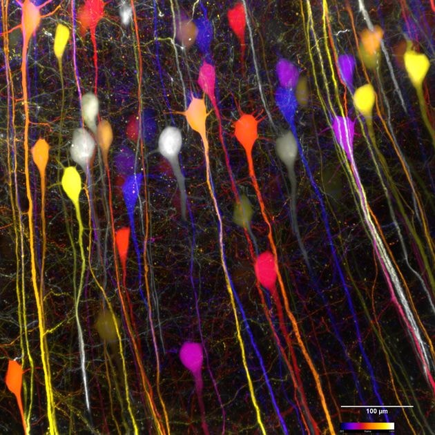Inner ear stem cells restore hearing (photo 2 of 2)