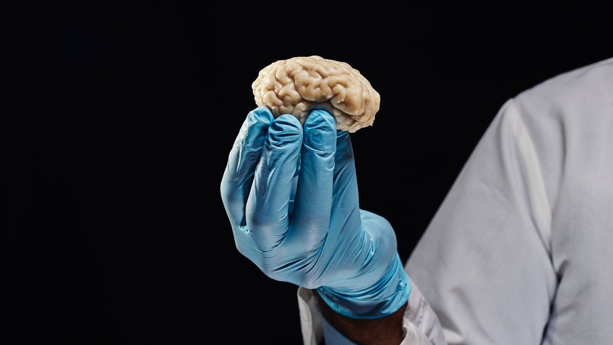 Human brain detached from living body (photo 2 of 2)