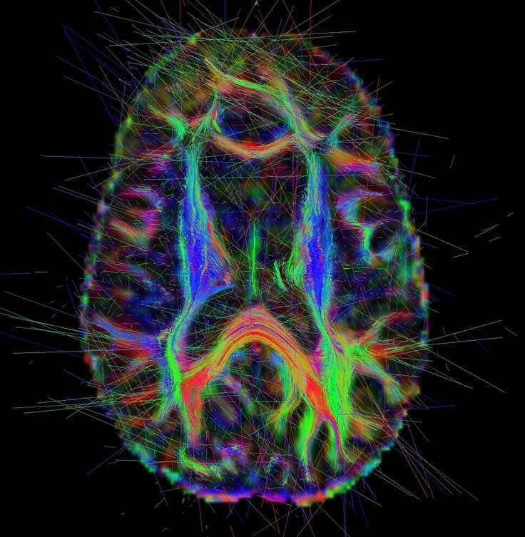 gratitude reshapes the brain
