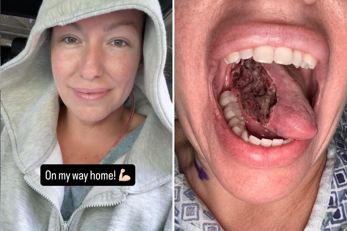 News Rachel Passarella Tongue Cancer Diagnosis News Rachel Passarella Tongue Cancer Diagnosis