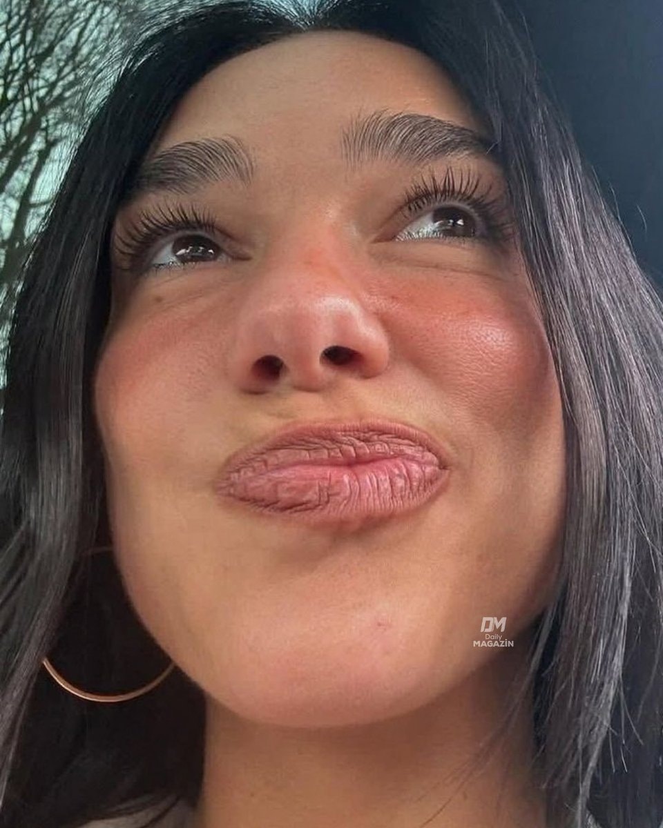 Dua Lipa lemon skincare