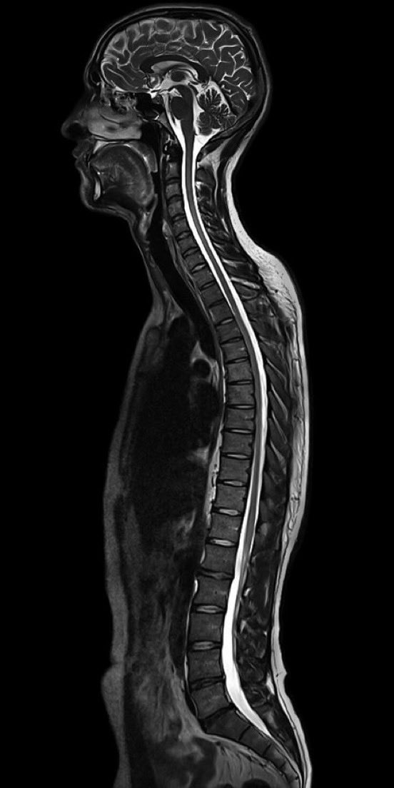 MRI scan of human head and spine