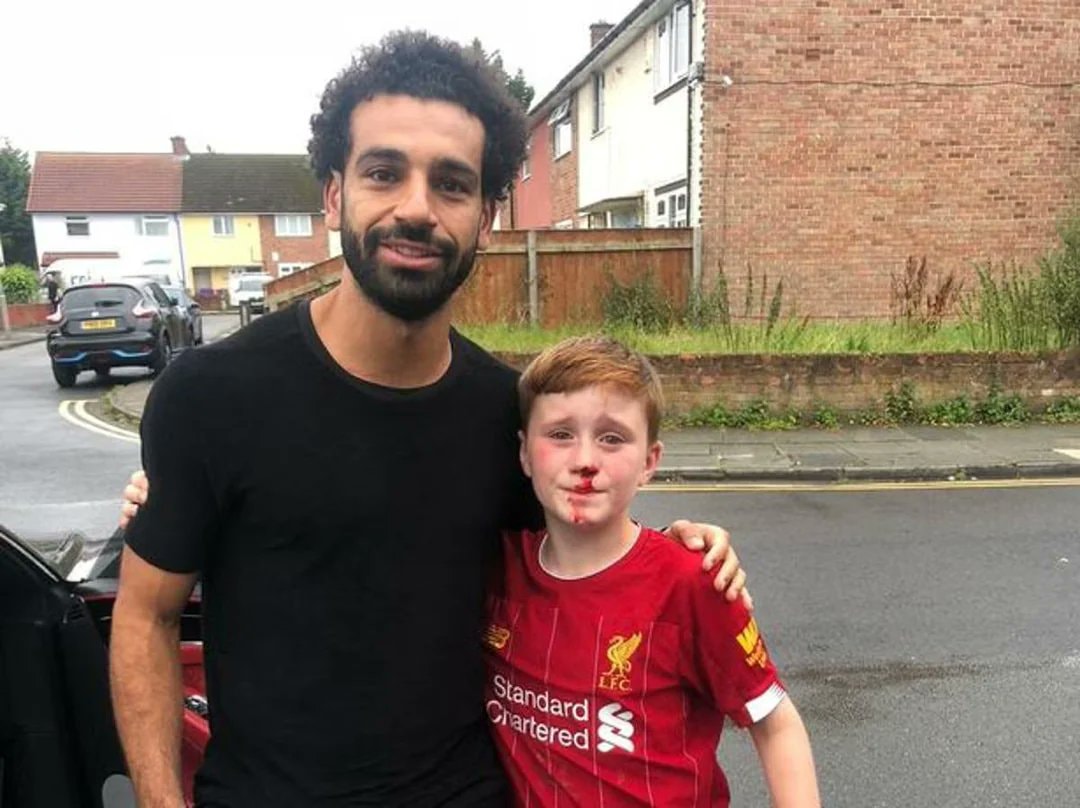 Salah and young Liverpool fan bloody nose photo