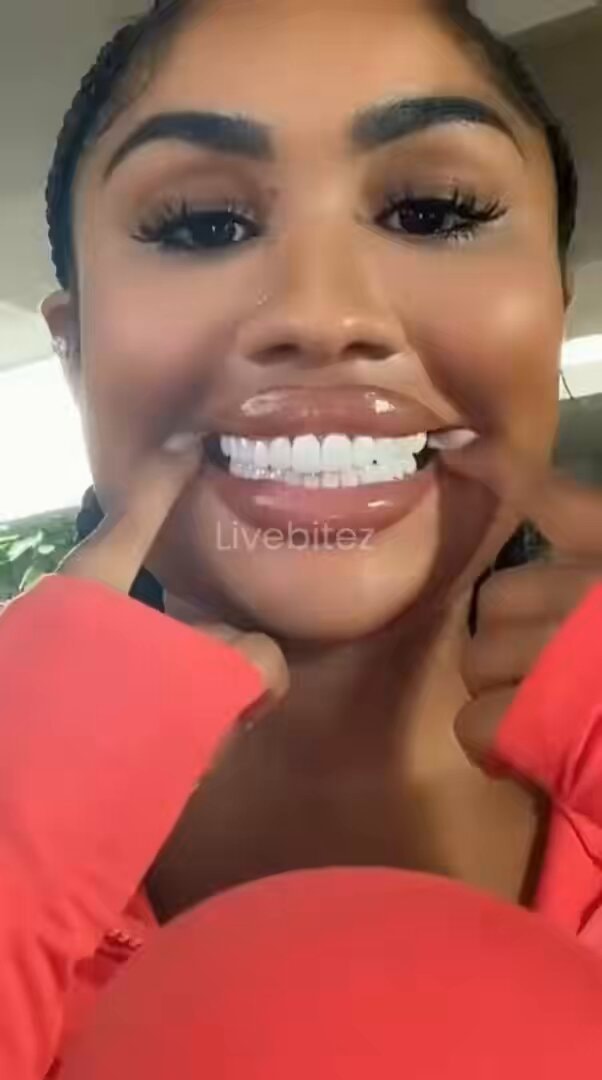 Ari Fletcher new teeth