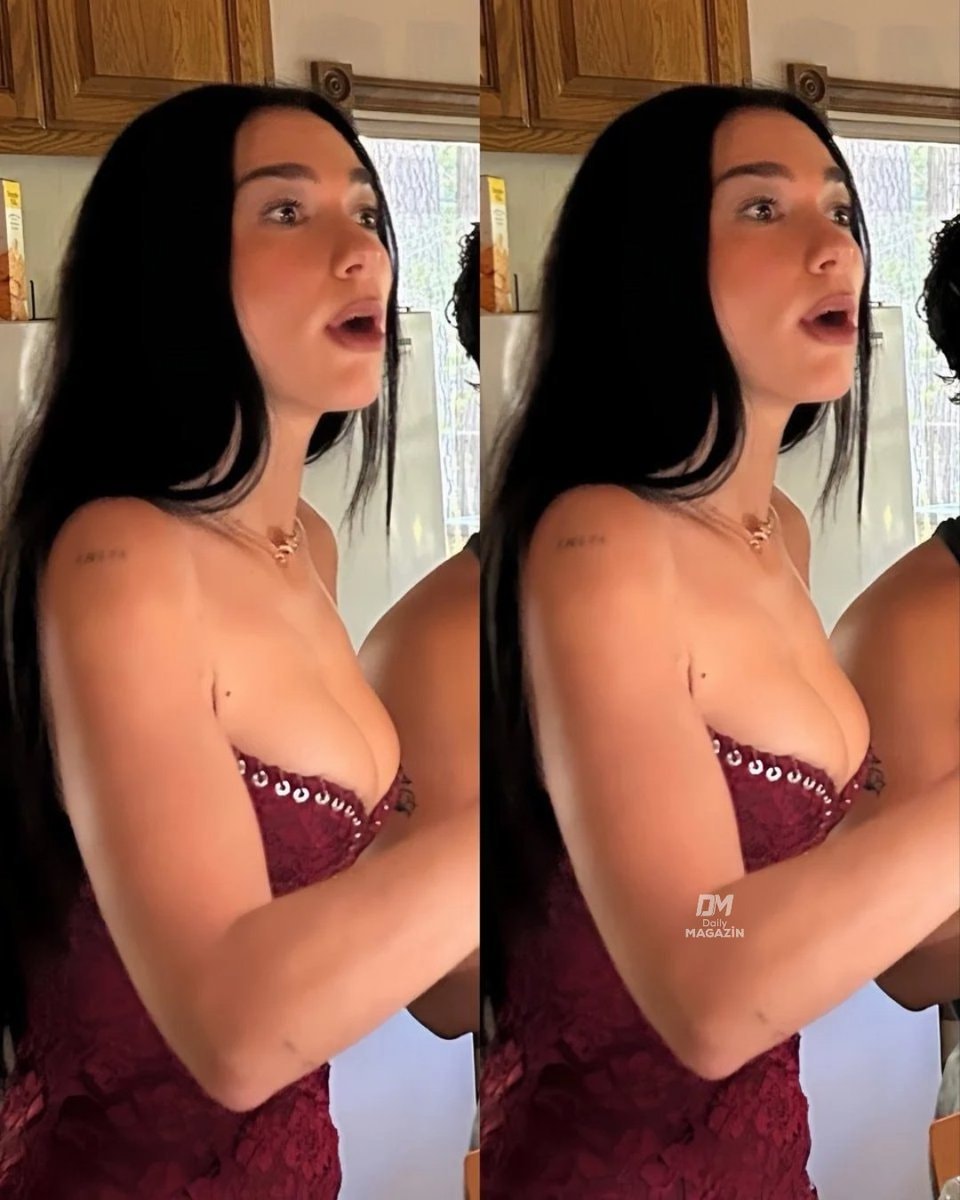 Dua Lipa full lips