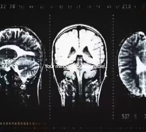 medical scan brain map