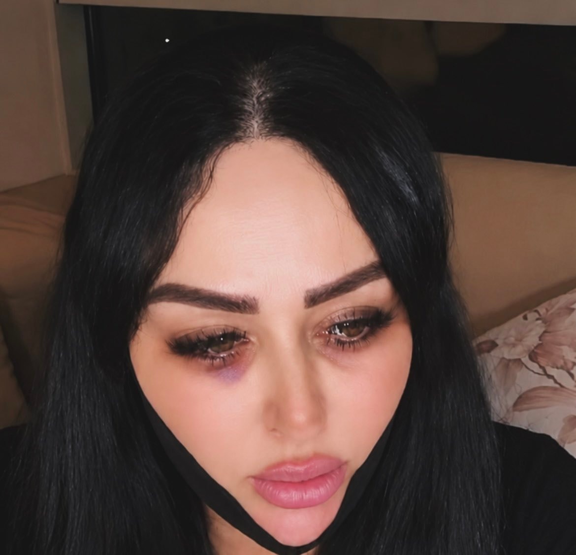 Yazgül defends new aesthetic (photo 2 of 2)