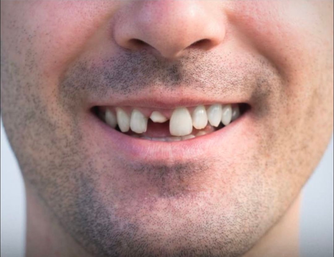 Tooth regrowing drug human trials Japan (photo 2 of 2)