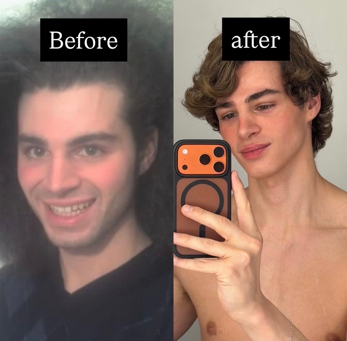 40 year old glow up before and after