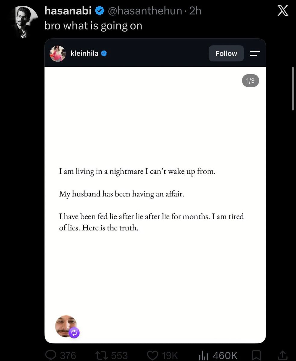 Hasan on Ethan Klein affair (photo 2 of 2)