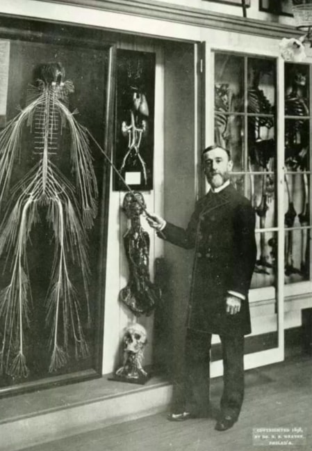 1925 preserved human nervous system (photo 1 of 2) 1925 preserved human nervous system (photo 1 of 2)