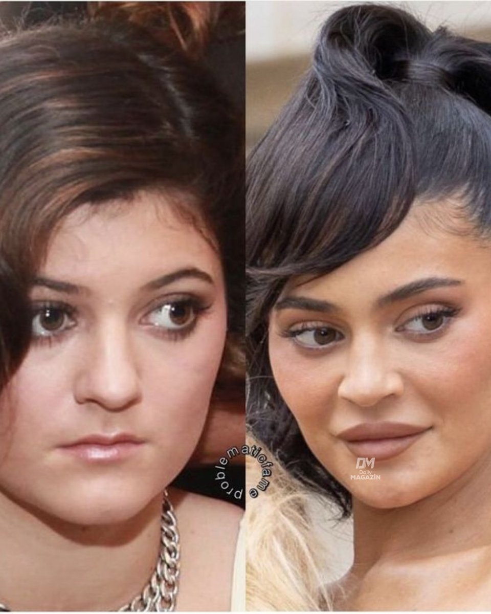 Kylie Jenner appearance change