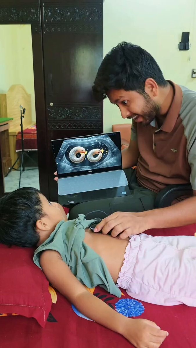 funny baby ultrasound moment