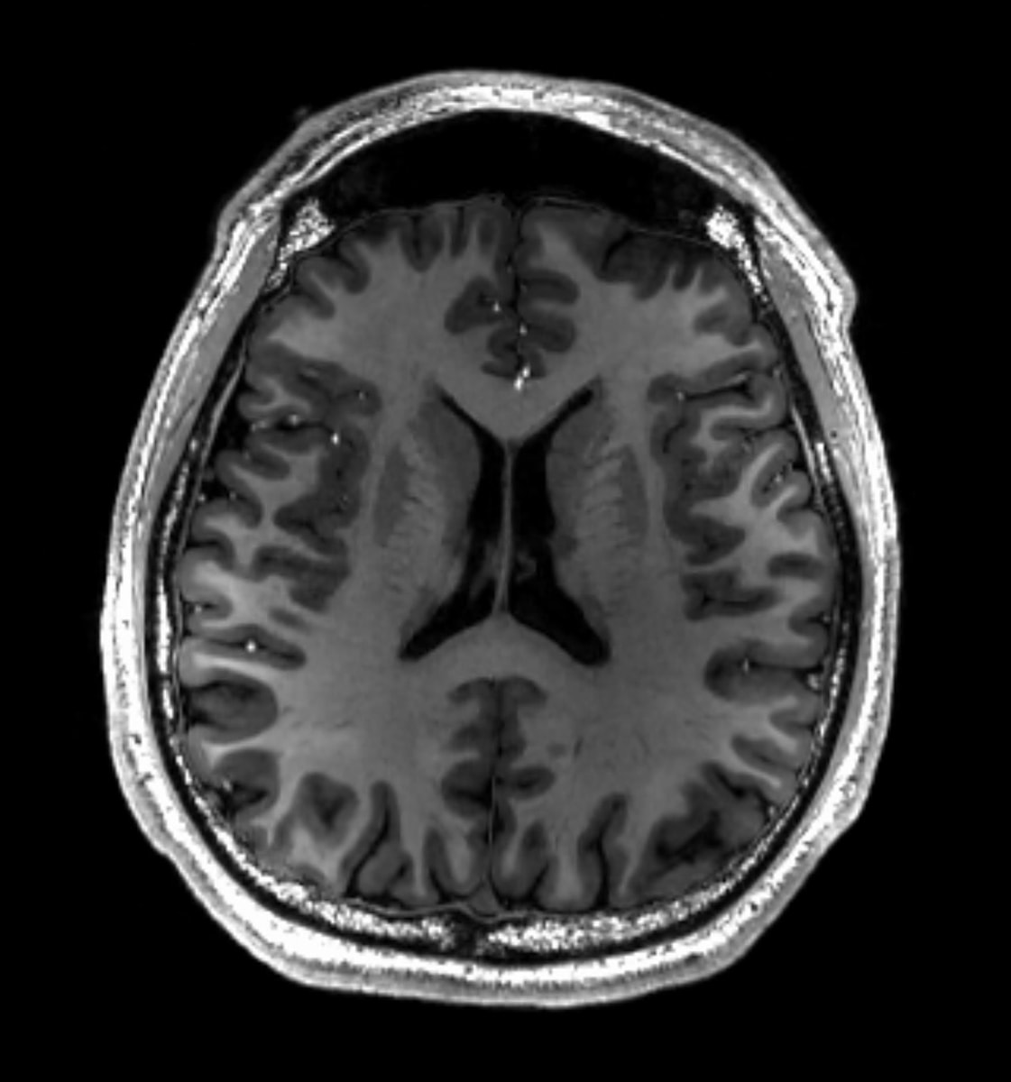 Brain scans children unstable families combat soldiers (photo 2 of 2)