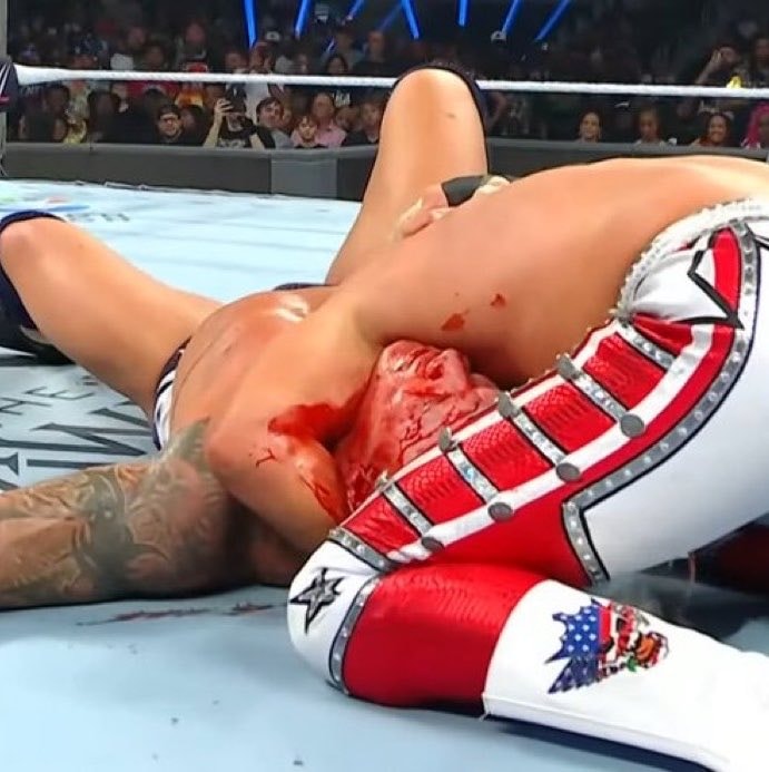 Randy Orton SNME moment (photo 2 of 2)