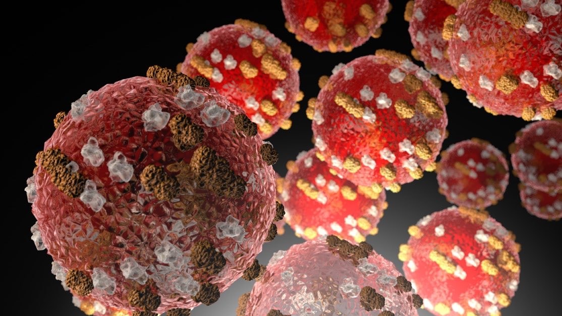 Measles deaths in Pennsylvania