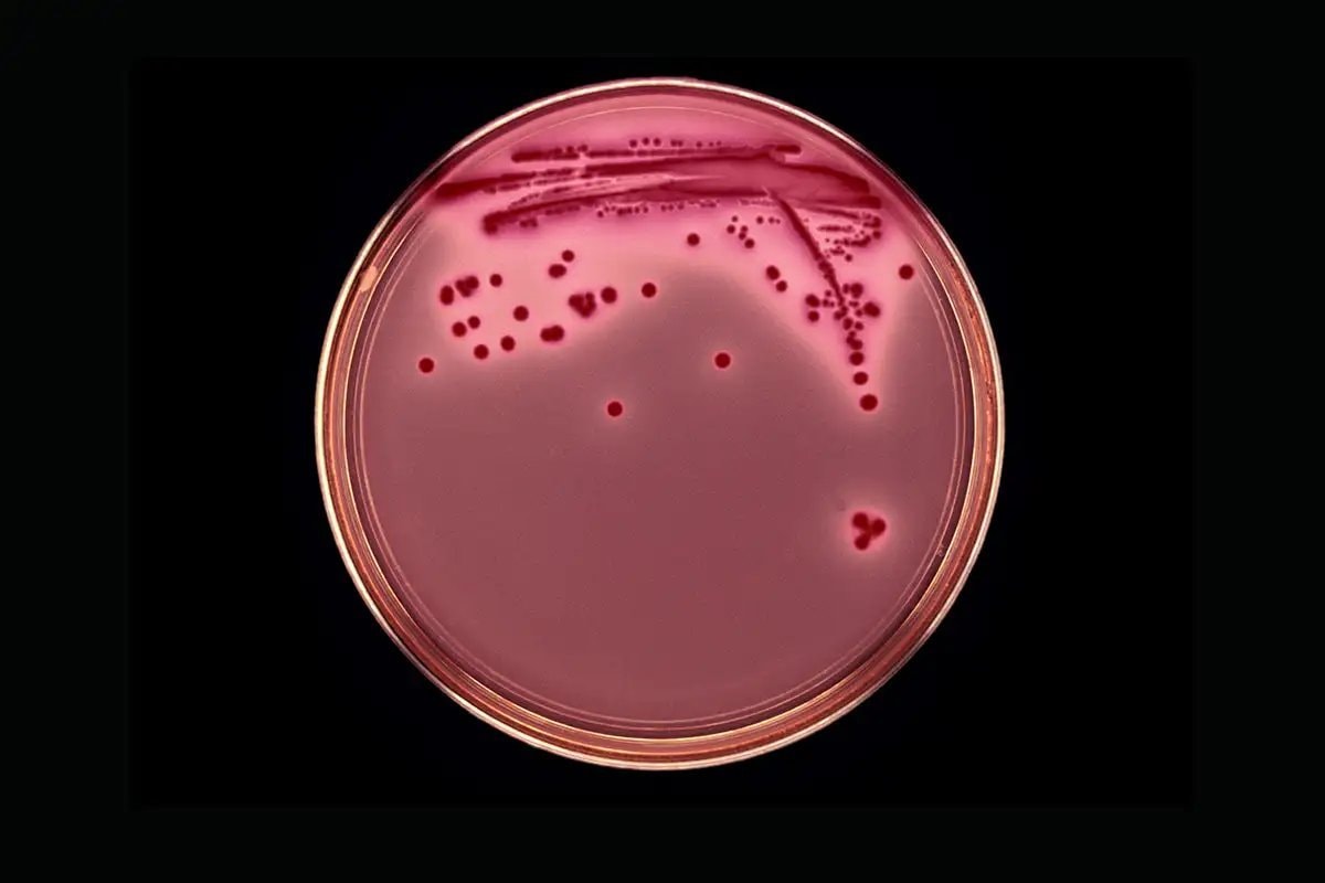 sperm behavior in microgravity (photo 2 of 2)