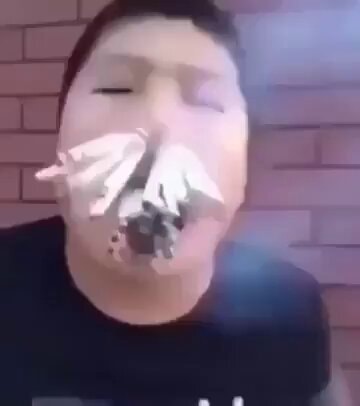 person with tissues in nose