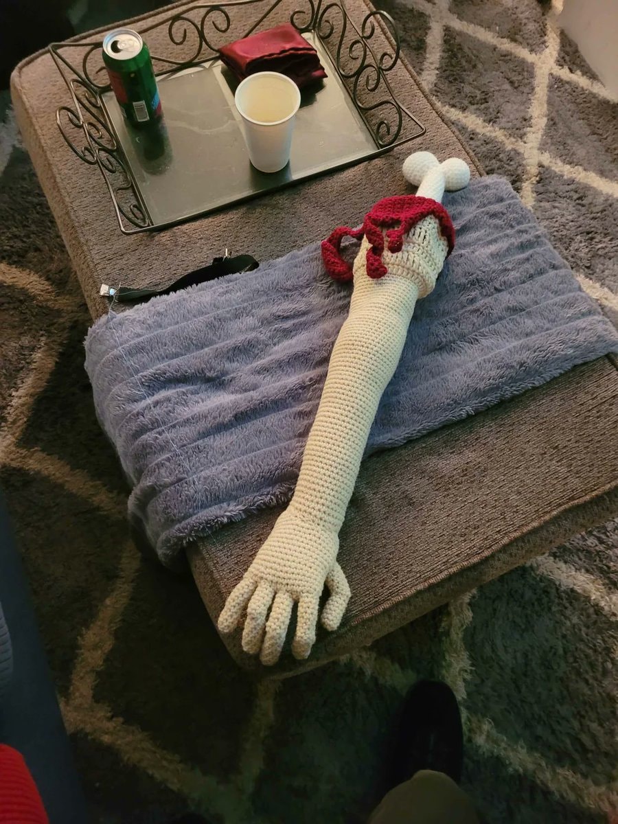 cousin crochets prosthetic arm (photo 3 of 4)