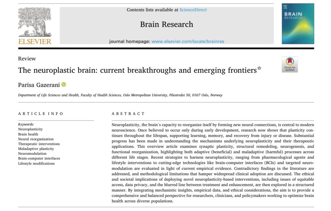 Neuroplasticity article by Parisa Gazera