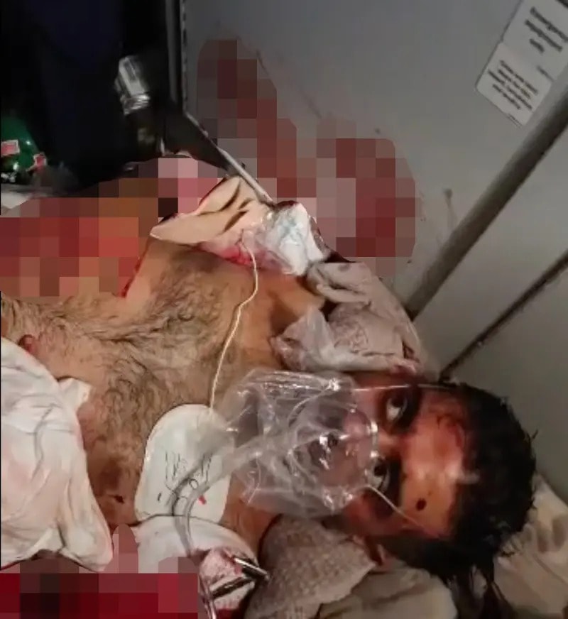 Indian pilot stabbed FlyDubai (photo 2 of 2)