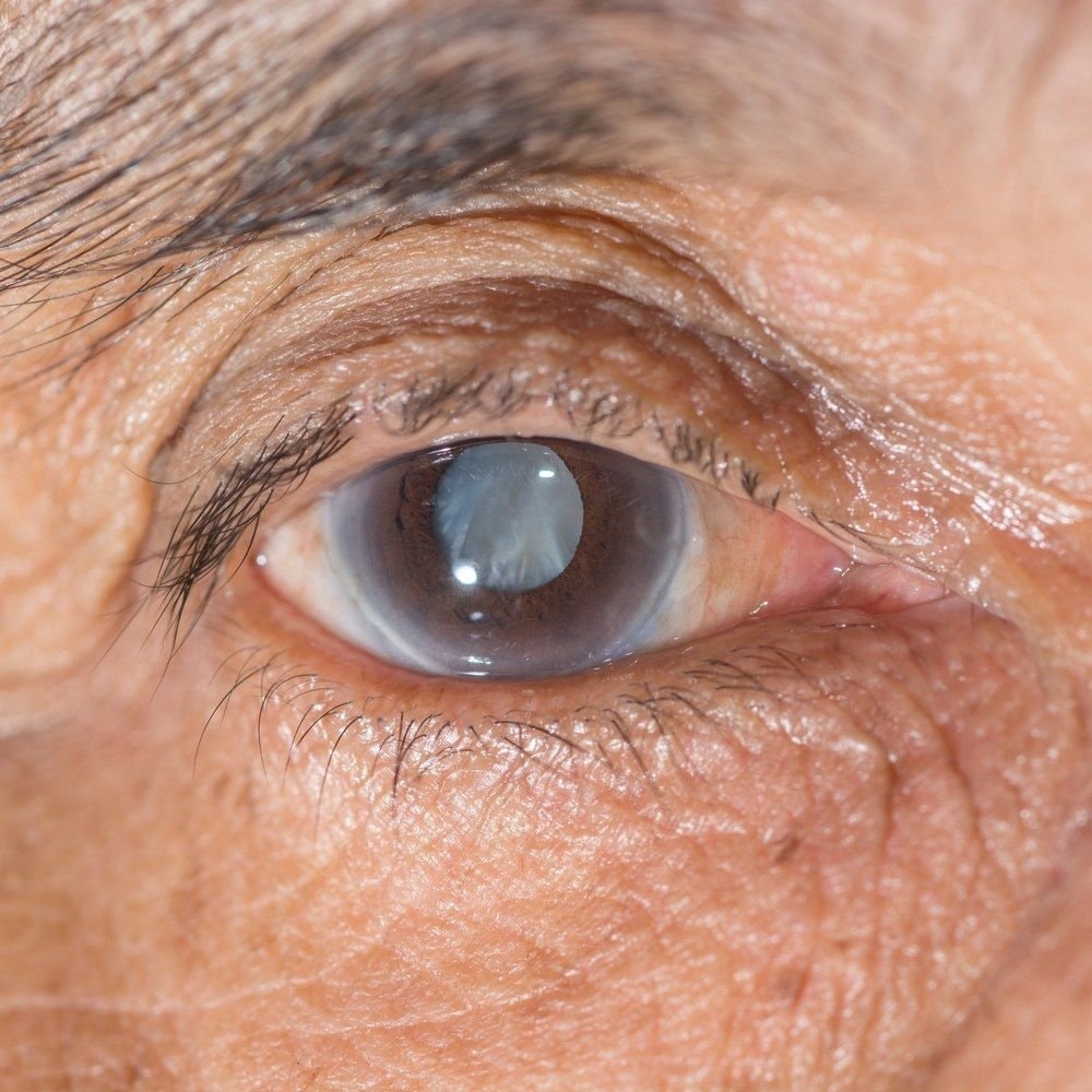 VIZZ eye drops for near vision (photo 2 of 2)