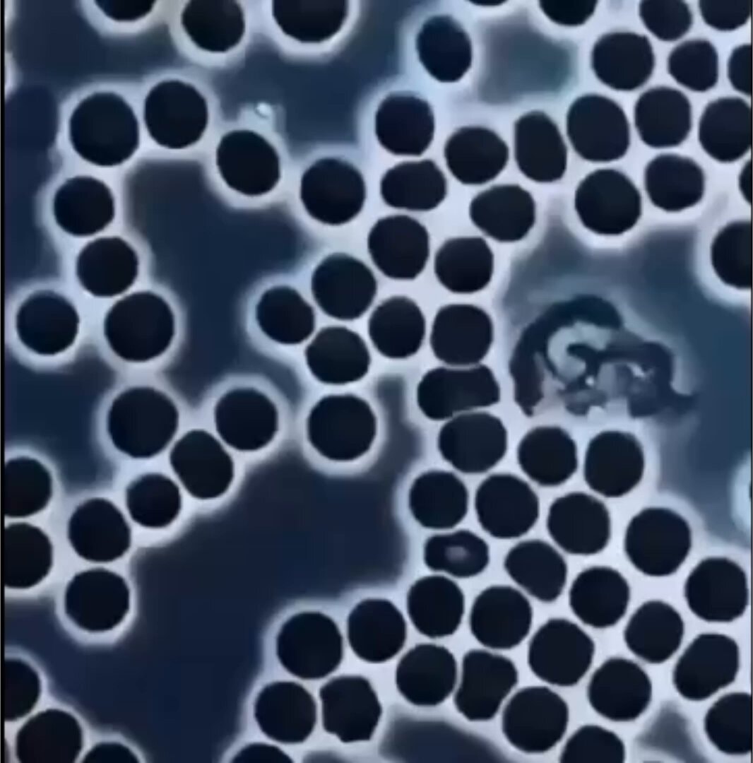 white blood cell inspecting red blood cells
