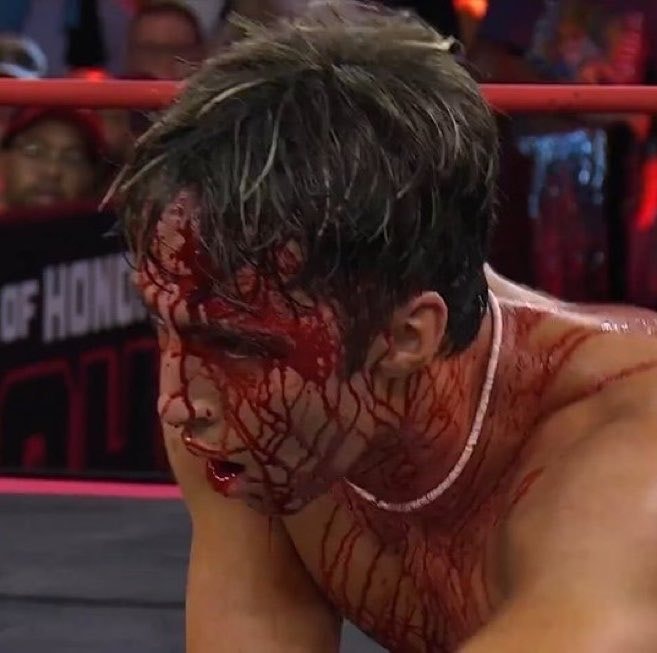 Nick Wayne ROH Blood Incident (photo 2 of 2)