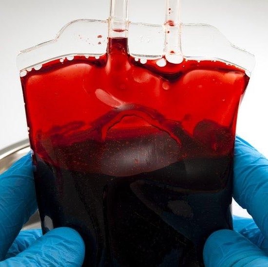 President Trump blood statement (photo 2 of 2)