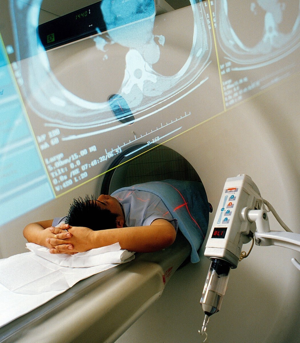 CT scan reveals chest cavity details