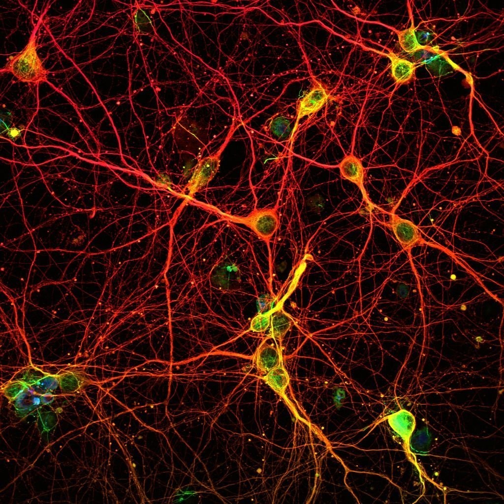 Brain training positive focus research (photo 2 of 2)