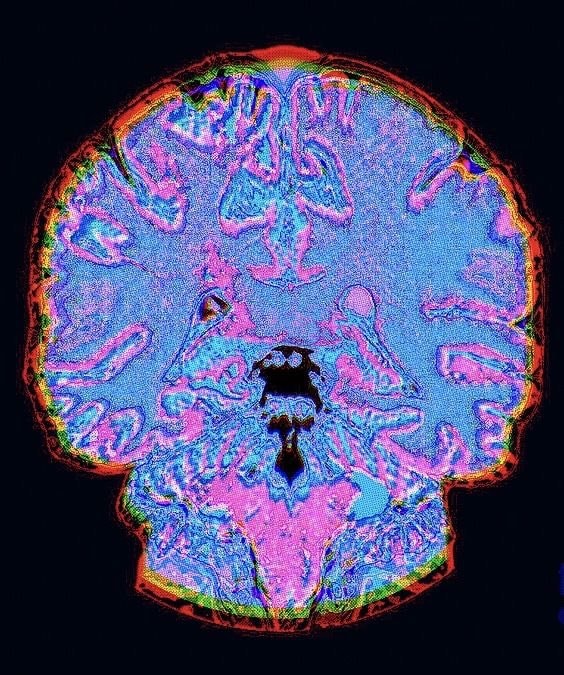 Sour candy and panic attacks