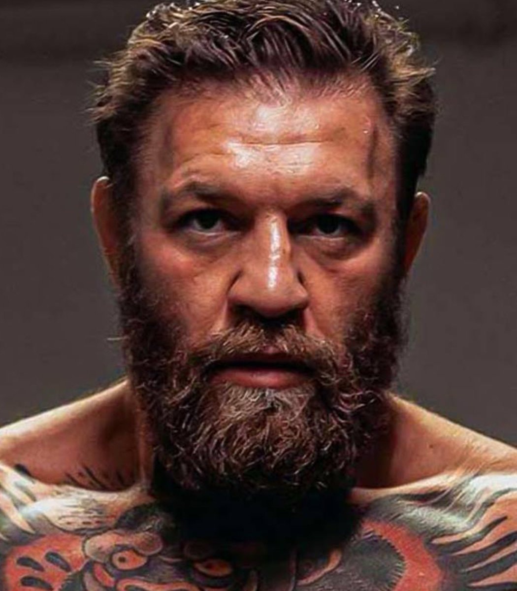 Conor McGregor leg injury UFC return (photo 1 of 2)