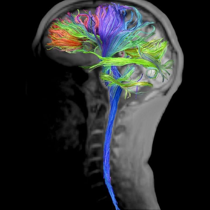 gratitude reshapes the brain (photo 2 of 2)