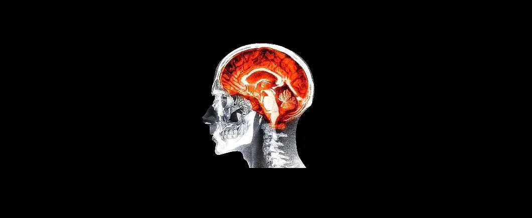 MRI scan of human brain ages