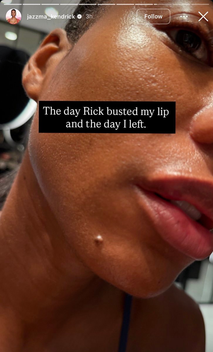 Jazzma Kendrick Rick Ross abuse allegations (photo 2 of 4)