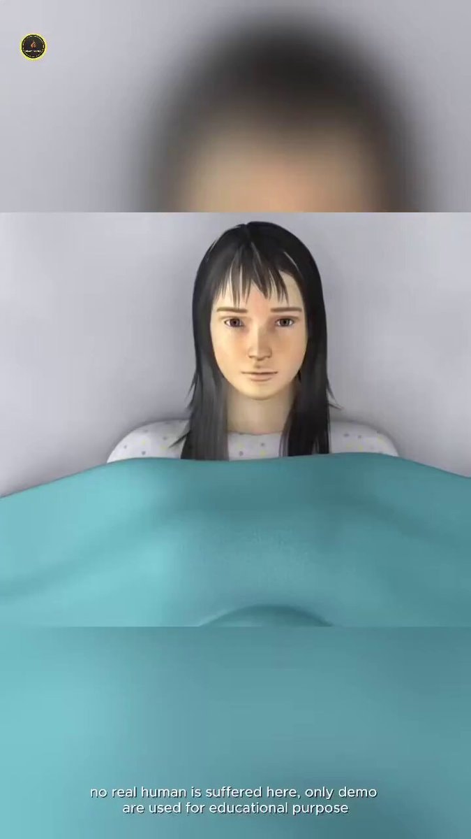 Female catheterization bladder rescue demo