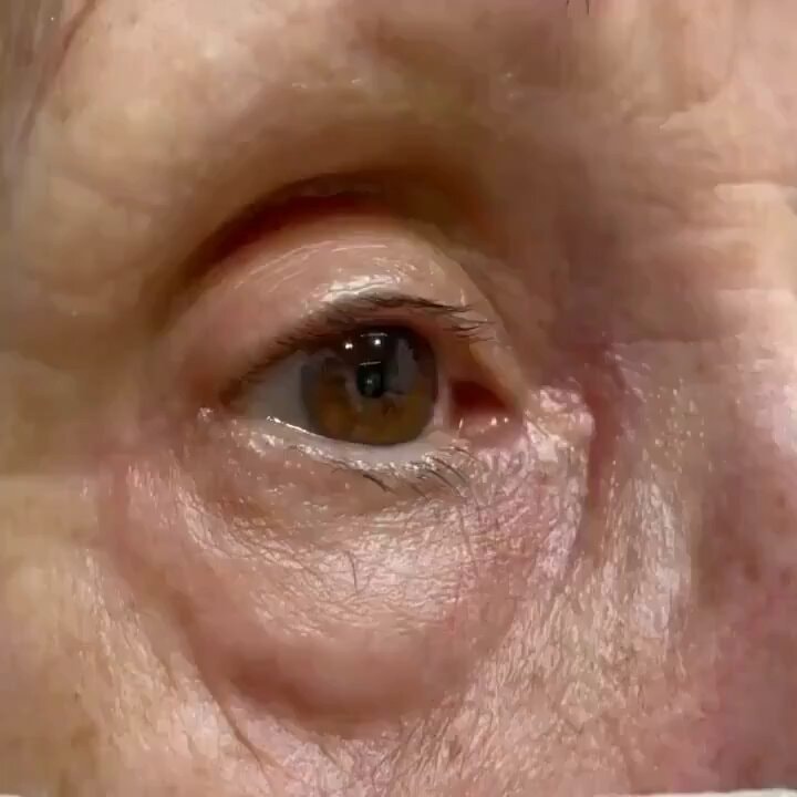 President Trump eye close-up