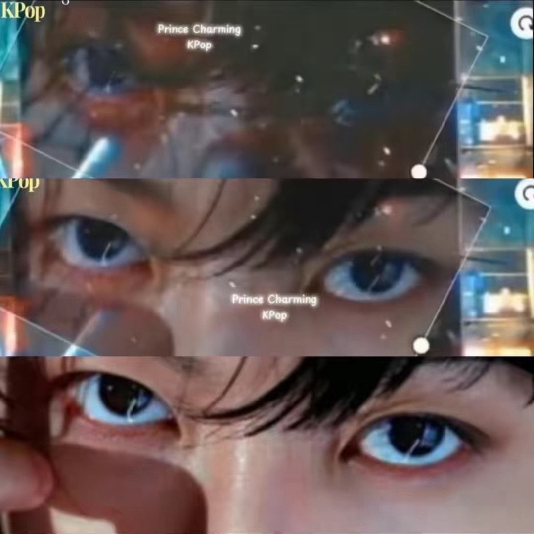 Jung Kook eye speculation (photo 2 of 4) Jung Kook eye speculation (photo 2 of 4)