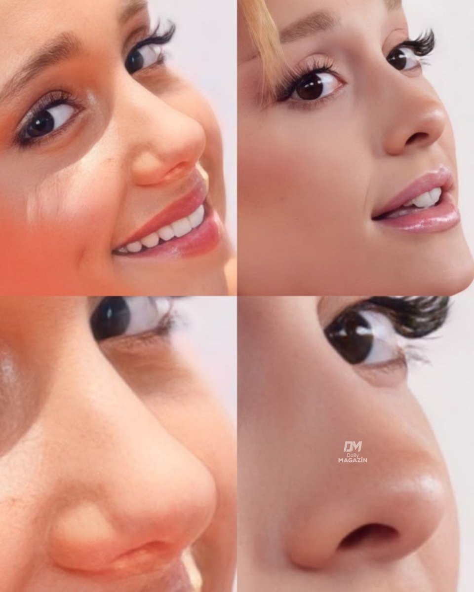Ariana Grande nose aesthetic claims Ariana Grande nose aesthetic claims