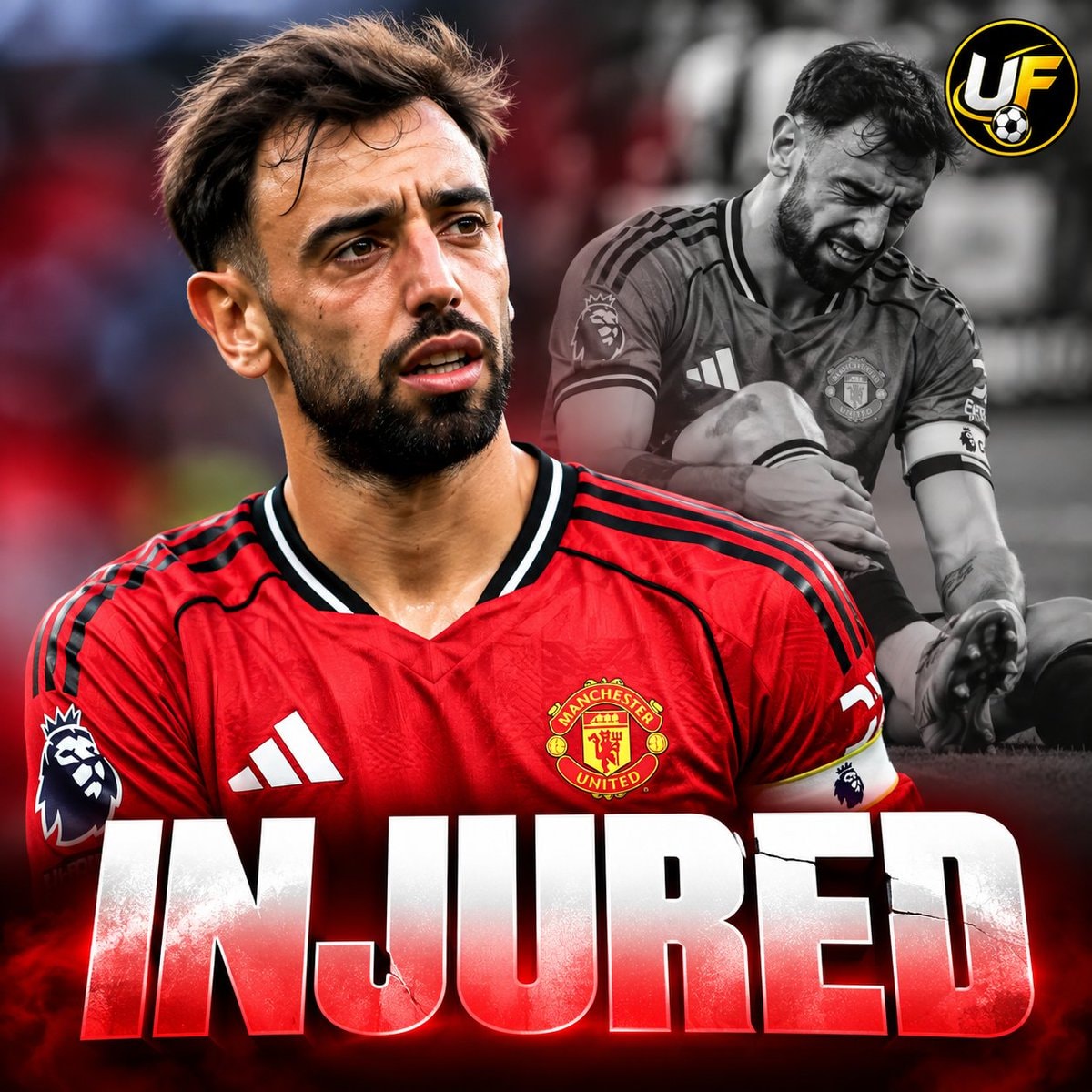 Bruno Fernandes injured