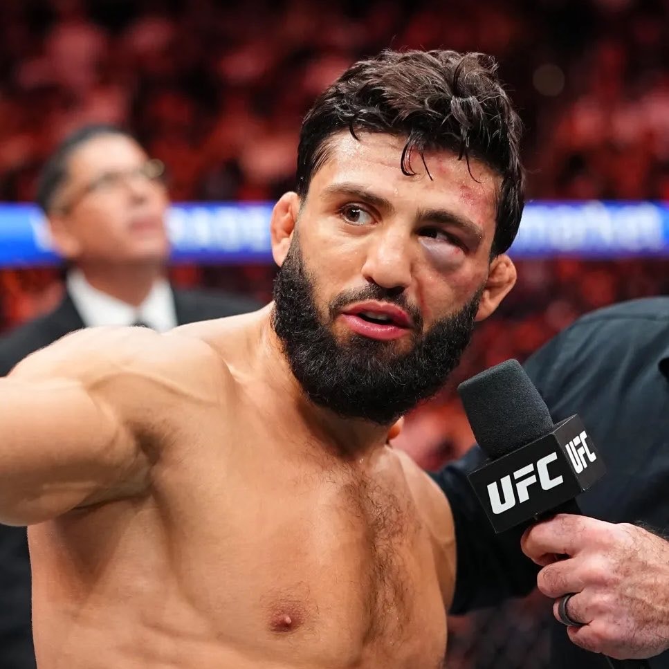 Arman Tsarukyan eye post-UFC331