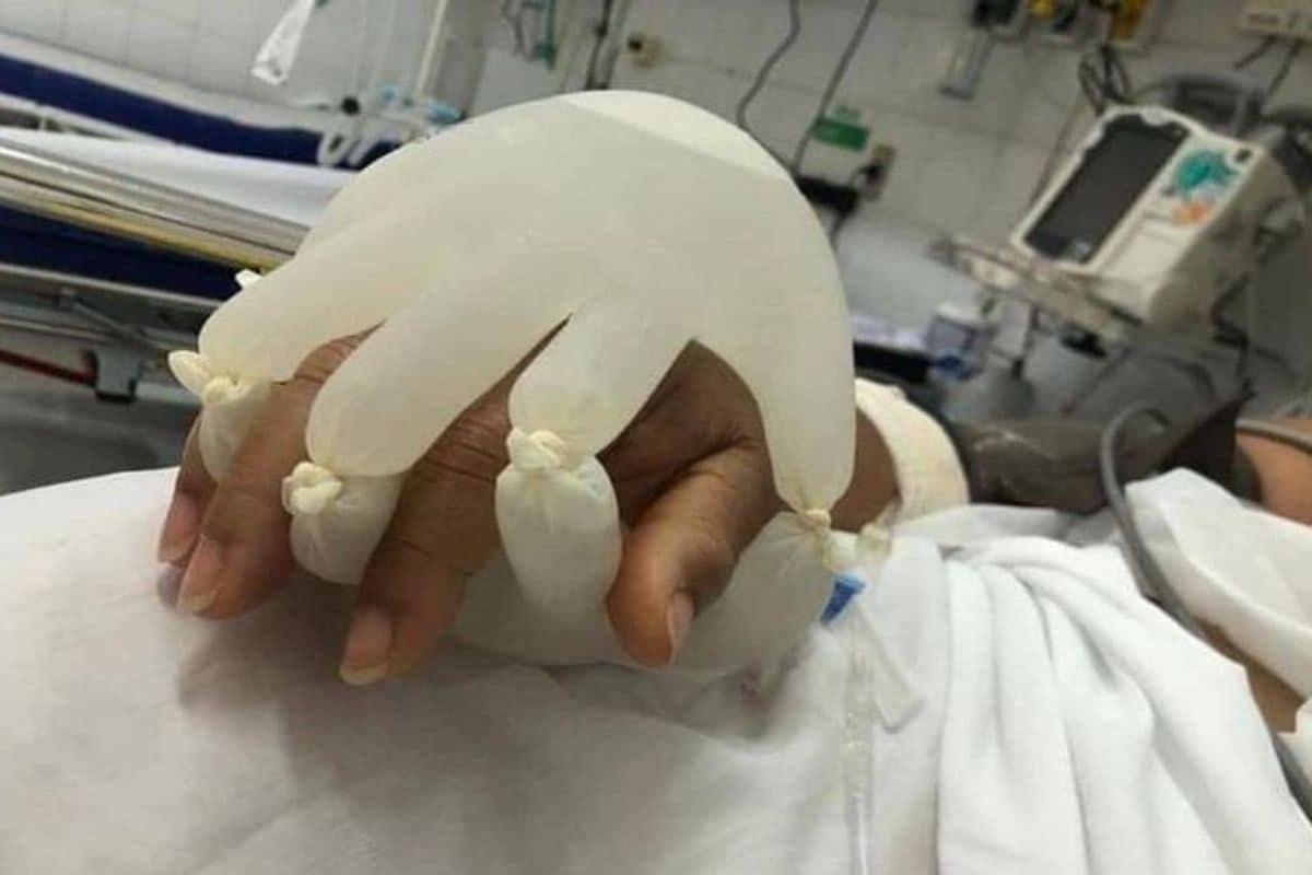 Nurses warm water glove comfort