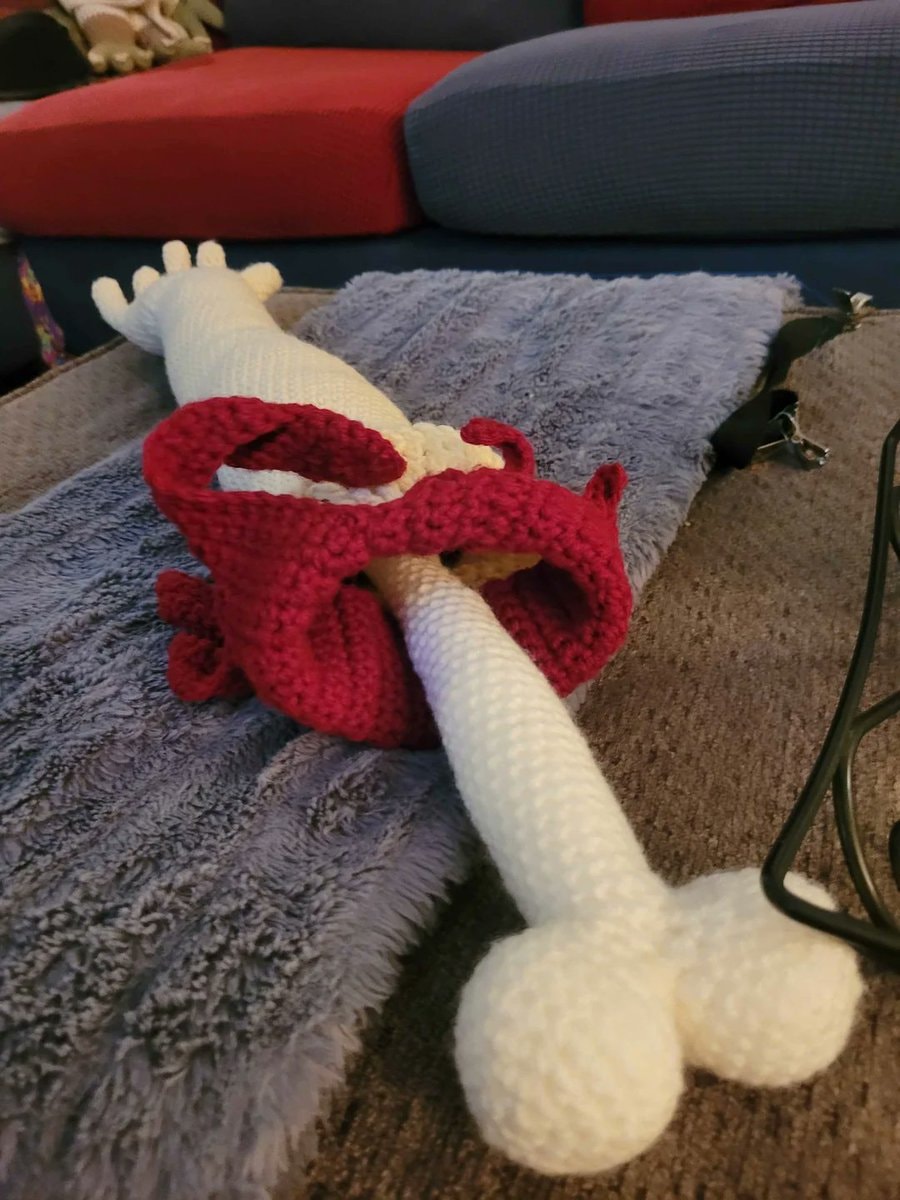 cousin crochets prosthetic arm (photo 4 of 4)