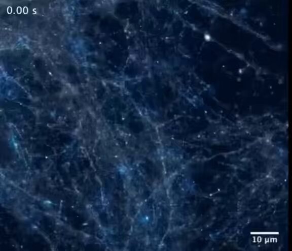 neurons firing in the brain