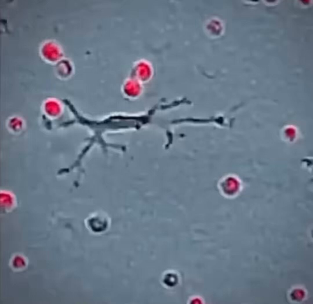 white blood cells protecting the body white blood cells protecting the body