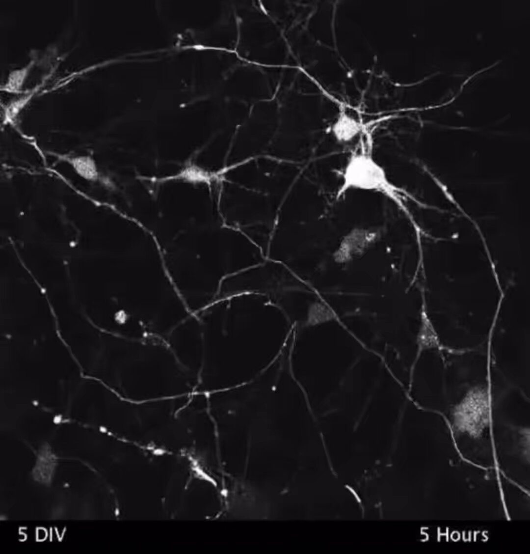 neuroplasticity and thought repetition