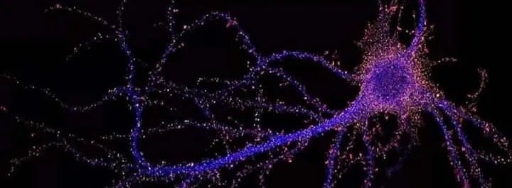 Neuron pattern recognition