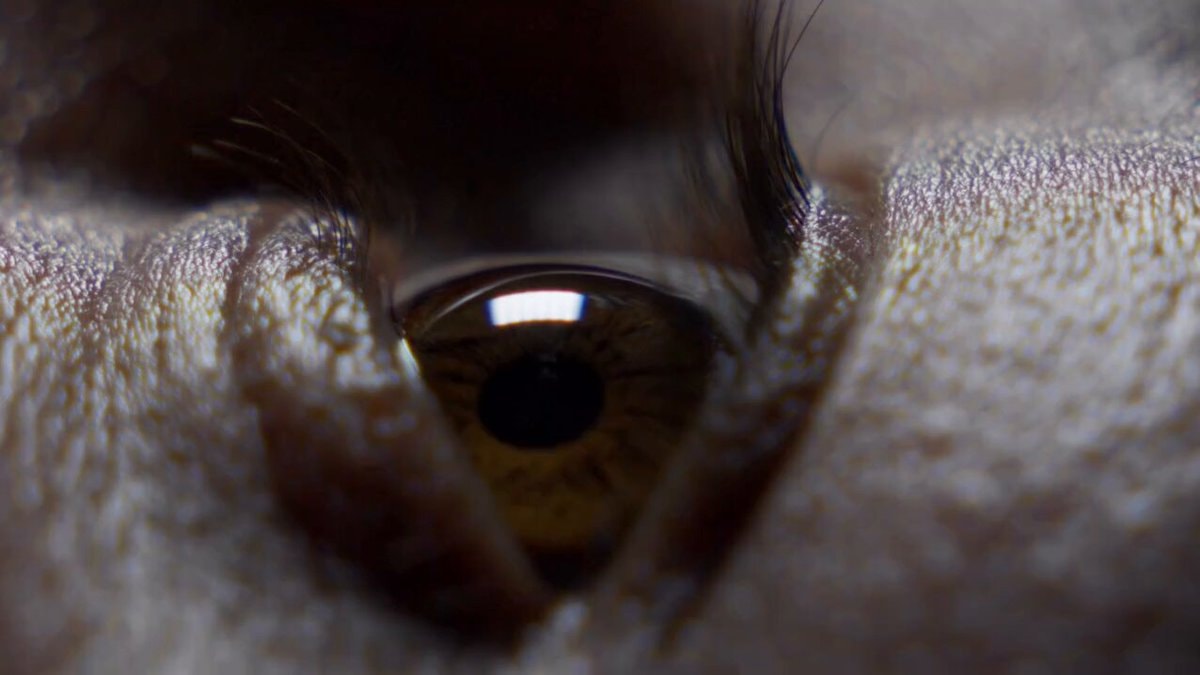 brown eye neuroplasticity