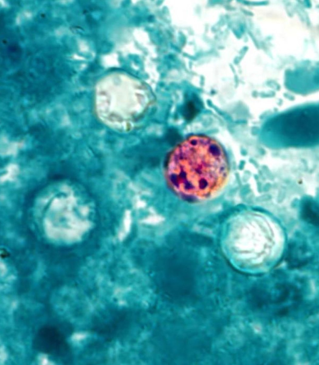 Cyclosporiasis outbreak 17 states (photo 2 of 2)